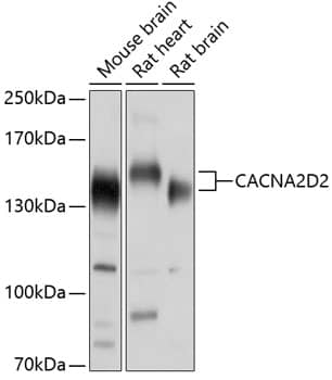 Western Blot: CACNA2D2 Antibody [NBP3-35118] - Western blot analysis of various lysates using CACNA2D2 Rabbit pAb at 1:1000 dilution.Secondary antibody: HRP-conjugated Goat anti-Rabbit IgG (H+L) at 1:10000 dilution.Lysates/proteins: 25ug per lane.Blocking buffer: 3% nonfat dry milk in TBST.Detection: ECL Enhanced Kit.Exposure time: 1s.