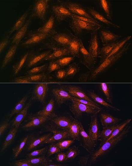 Immunocytochemistry/ Immunofluorescence: DUSP14 Antibody [NBP3-35121] - Immunofluorescence analysis of H9C2 cells using DUSP14 Rabbit pAb at dilution of 1:100. Secondary antibody: Cy3-conjugated Goat anti-Rabbit IgG (H+L) at 1:500 dilution. Blue: DAPI for nuclear staining.