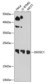 Western Blot: Exosome component 1 Antibody [NBP3-35122] - Western blot analysis of various lysates using Exosome component 1 Rabbit pAb at 1:1000 dilution.Secondary antibody: HRP-conjugated Goat anti-Rabbit IgG (H+L) at 1:10000 dilution.Lysates/proteins: 25ug per lane.Blocking buffer: 3% nonfat dry milk in TBST.Detection: ECL Basic Kit.Exposure time: 90s.