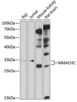 Western Blot: MMACHC Antibody [NBP3-35126] - Western blot analysis of various lysates using MMACHC Rabbit pAb at 1:1000 dilution.Secondary antibody: HRP-conjugated Goat anti-Rabbit IgG (H+L) at 1:10000 dilution.Lysates/proteins: 25ug per lane.Blocking buffer: 3% nonfat dry milk in TBST.Detection: ECL Basic Kit.Exposure time: 20s.