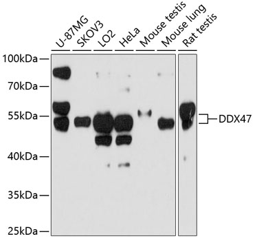 Western Blot: DDX47 Antibody [NBP3-35128] - Western blot analysis of various lysates using DDX47 Rabbit pAb at 1:1000 dilution.Secondary antibody: HRP-conjugated Goat anti-Rabbit IgG (H+L) at 1:10000 dilution.Lysates/proteins: 25ug per lane.Blocking buffer: 3% nonfat dry milk in TBST.Detection: ECL Enhanced Kit.Exposure time: 90s.