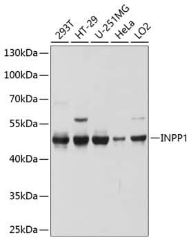 Western Blot: INPP1 Antibody [NBP3-35130] - Western blot analysis of various lysates using INPP1 Rabbit pAb at 1:1000 dilution.Secondary antibody: HRP-conjugated Goat anti-Rabbit IgG (H+L) at 1:10000 dilution.Lysates/proteins: 25ug per lane.Blocking buffer: 3% nonfat dry milk in TBST.Detection: ECL Basic Kit.Exposure time: 10s.