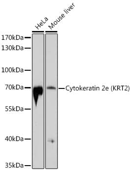 Western Blot: Cytokeratin 2 Antibody [NBP3-35131] - Western blot analysis of various lysates using Cytokeratin 2(KRT2) Rabbit pAb at 1:1000 dilution.Secondary antibody: HRP-conjugated Goat anti-Rabbit IgG (H+L) at 1:10000 dilution.Lysates/proteins: 25ug per lane.Blocking buffer: 3% nonfat dry milk in TBST.Detection: ECL Basic Kit.Exposure time: 90s.