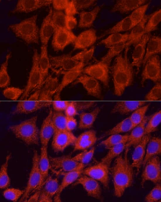 Immunocytochemistry/ Immunofluorescence: GCLC Antibody [NBP3-35132] - Immunofluorescence analysis of PC-12 cells using GCLC Rabbit pAb at dilution of 1:50 (40x lens). Secondary antibody: Cy3-conjugated Goat anti-Rabbit IgG (H+L) at 1:500 dilution. Blue: DAPI for nuclear staining.