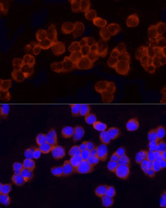 Immunocytochemistry/ Immunofluorescence: GCLC Antibody [NBP3-35132] - Immunofluorescence analysis of Jurkat cells using GCLC Rabbit pAb at dilution of 1:50 (40x lens). Secondary antibody: Cy3-conjugated Goat anti-Rabbit IgG (H+L) at 1:500 dilution. Blue: DAPI for nuclear staining.