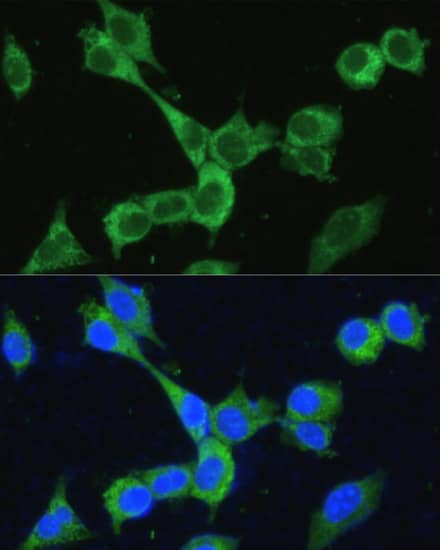 Immunocytochemistry/ Immunofluorescence: MTHFD2 Antibody [NBP3-35135] - Immunofluorescence analysis of NIH-3T3 cells using MTHFD2 Rabbit pAb at dilution of 1:100. Secondary antibody: Cy3-conjugated Goat anti-Rabbit IgG (H+L) at 1:500 dilution. Blue: DAPI for nuclear staining.