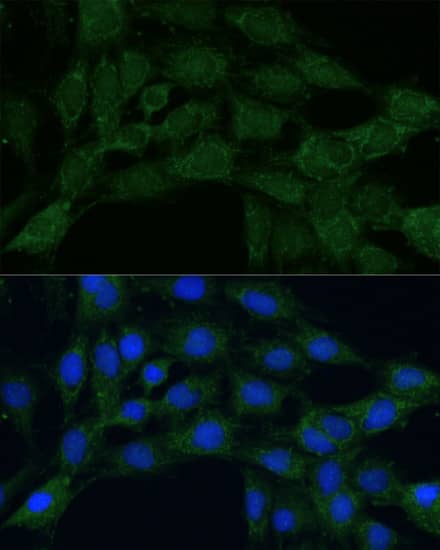 Immunocytochemistry/ Immunofluorescence: MTHFD2 Antibody [NBP3-35135] - Immunofluorescence analysis of C6 cells using MTHFD2 Rabbit pAb at dilution of 1:100. Secondary antibody: Cy3-conjugated Goat anti-Rabbit IgG (H+L) at 1:500 dilution. Blue: DAPI for nuclear staining.