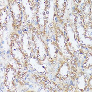 Immunohistochemistry: MTHFD2 Antibody [NBP3-35135] - Immunohistochemistry analysis of paraffin-embedded Rat kidney using MTHFD2 Rabbit pAb at dilution of 1:100 (40x lens). Microwave antigen retrieval performed with 0.01M PBS Buffer (pH 7.2) prior to IHC staining.