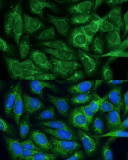 Immunocytochemistry/ Immunofluorescence: MTHFD2 Antibody [NBP3-35135] - Immunofluorescence analysis of U-2 OS cells using MTHFD2 Rabbit pAb at dilution of 1:100. Secondary antibody: Cy3-conjugated Goat anti-Rabbit IgG (H+L) at 1:500 dilution. Blue: DAPI for nuclear staining.
