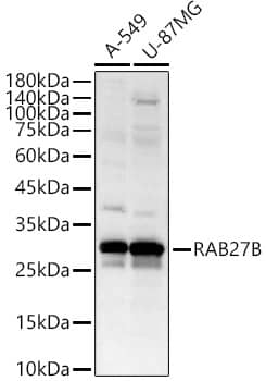 Western Blot: RAB27B Antibody [NBP3-35136] - Western blot analysis of various lysates, using RAB27B Rabbit pAb at  1:1000 dilution.Secondary antibody: HRP-conjugated Goat anti-Rabbit IgG (H+L) at 1:10000 dilution.Lysates/proteins: 25ug per lane.Blocking buffer: 3% nonfat dry milk in TBST.Detection: ECL Basic Kit.Exposure time: 25s.