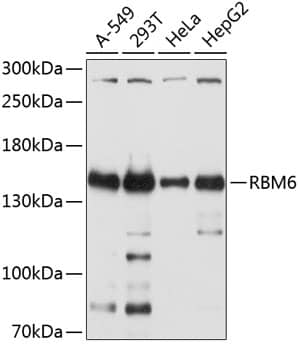 Western Blot: RBM6 Antibody [NBP3-35137] - Western blot analysis of various lysates using RBM6 Rabbit pAb at 1:2000 dilution.Secondary antibody: HRP-conjugated Goat anti-Rabbit IgG (H+L) at 1:10000 dilution.Lysates/proteins: 25ug per lane.Blocking buffer: 3% nonfat dry milk in TBST.Detection: ECL Basic Kit.Exposure time: 5s.