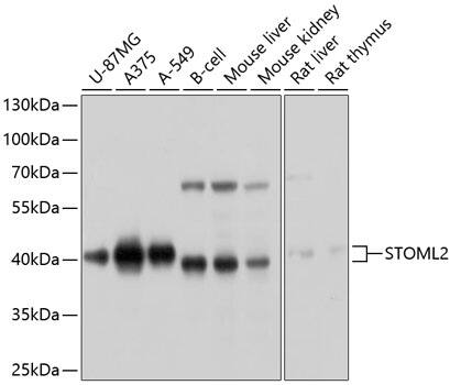 Western Blot: SLP-2 Antibody [NBP3-35139] - Western blot analysis of various lysates using SLP-2 Rabbit pAb at 1:1000 dilution.Secondary antibody: HRP-conjugated Goat anti-Rabbit IgG (H+L) at 1:10000 dilution.Lysates/proteins: 25ug per lane.Blocking buffer: 3% nonfat dry milk in TBST.Detection: ECL Basic Kit.Exposure time: 10s.