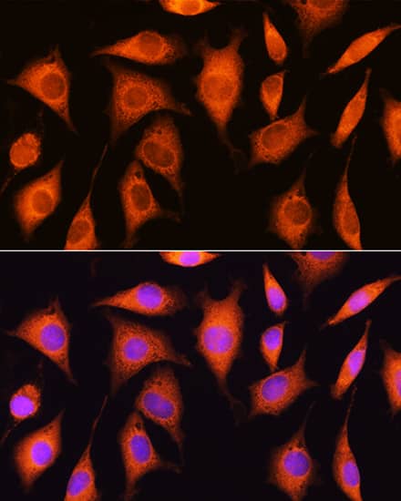 Immunocytochemistry/ Immunofluorescence RRP4 Antibody