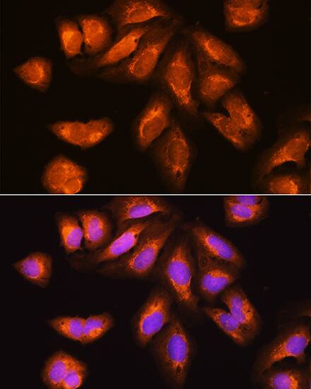 Immunocytochemistry/ Immunofluorescence: RRP4 Antibody [NBP3-35142] - Immunofluorescence analysis of U2OS cells using RRP4 Rabbit pAb at dilution of 1:100. Secondary antibody: Cy3-conjugated Goat anti-Rabbit IgG (H+L) at 1:500 dilution. Blue: DAPI for nuclear staining.