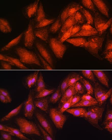 Immunocytochemistry/ Immunofluorescence RRP4 Antibody