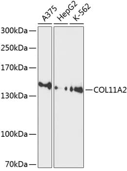 Western Blot: Collagen XI alpha 2 Antibody [NBP3-35144] - Western blot analysis of various lysates using Collagen XI alpha 2 Rabbit pAb at 1:1000 dilution.Secondary antibody: HRP-conjugated Goat anti-Rabbit IgG (H+L) at 1:10000 dilution.Lysates/proteins: 25ug per lane.Blocking buffer: 3% nonfat dry milk in TBST.Detection: ECL Basic Kit.Exposure time: 90s.