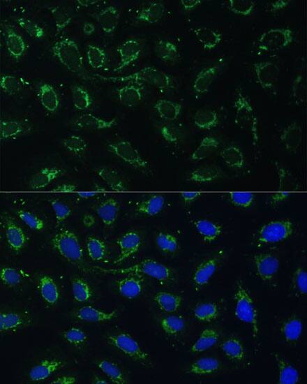 Immunocytochemistry/ Immunofluorescence: AKR1C2 Antibody [NBP3-35145] - Immunofluorescence analysis of U-2 OS cells using AKR1C2 Rabbit pAb at dilution of 1:100 (40x lens). Secondary antibody: Cy3-conjugated Goat anti-Rabbit IgG (H+L) at 1:500 dilution. Blue: DAPI for nuclear staining.