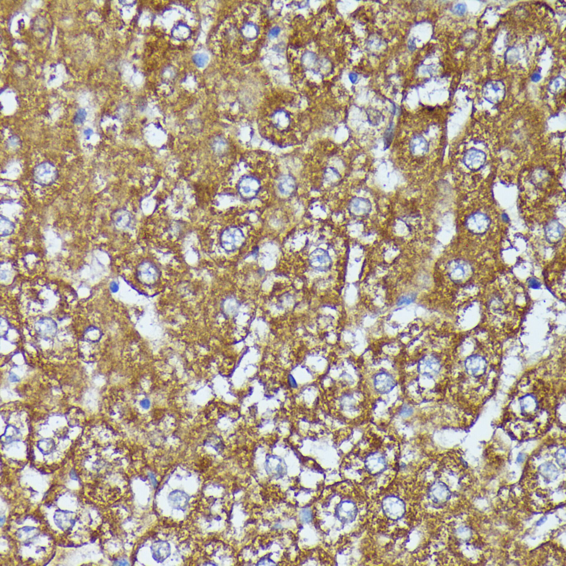 Immunohistochemistry: AKR1C2 Antibody [NBP3-35145] - Immunohistochemistry analysis of paraffin-embedded Rat liver using AKR1C2 Rabbit pAb at dilution of 1:100 (40x lens). Microwave antigen retrieval performed with 0.01M PBS Buffer (pH 7.2) prior to IHC staining.