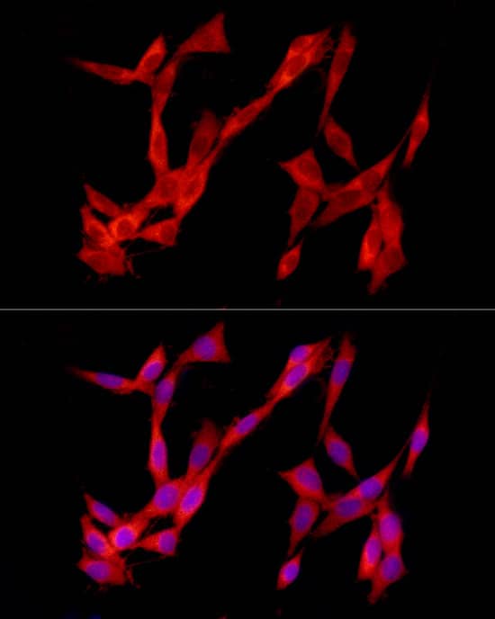 Immunocytochemistry/ Immunofluorescence: TREM2 Antibody [NBP3-35146] - Immunofluorescence analysis of PC-12 cells using TREM2 Rabbit pAb at dilution of 1:50 (40x lens). Secondary antibody: Cy3-conjugated Goat anti-Rabbit IgG (H+L) at 1:500 dilution. Blue: DAPI for nuclear staining.