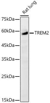 Western Blot: TREM2 Antibody [NBP3-35146] - Western blot analysis of lysates from Rat lung using TREM2 Rabbit pAb at 1:2000 dilution.Secondary antibody: HRP-conjugated Goat anti-Rabbit IgG (H+L) at 1:10000 dilution.Lysates/proteins: 25 ug per lane.Blocking buffer: 3% nonfat dry milk in TBST.Detection: ECL Basic Kit.Exposure time: 30s.