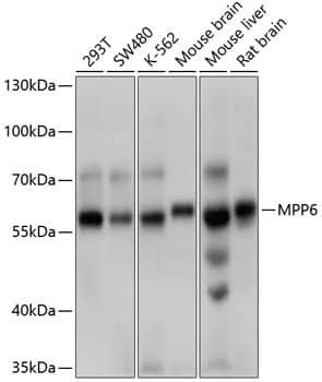 Western Blot: VAM1 Antibody [NBP3-35148] - Western blot analysis of various lysates using VAM1 Rabbit pAb at 1:1000 dilution.Secondary antibody: HRP-conjugated Goat anti-Rabbit IgG (H+L) at 1:10000 dilution.Lysates/proteins: 25ug per lane.Blocking buffer: 3% nonfat dry milk in TBST.Detection: ECL Basic Kit.Exposure time: 1s.