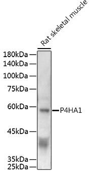 Western Blot: P4HA1 Antibody [NBP3-35149] - Western blot analysis of lysates from Rat skeletal muscle, using P4HA1 Rabbit pAb at 1:500 dilution.Secondary antibody: HRP-conjugated Goat anti-Rabbit IgG (H+L) at 1:10000 dilution.Lysates/proteins: 25ug per lane.Blocking buffer: 3% nonfat dry milk in TBST.Detection: ECL Enhanced Kit.Exposure time: 120s.