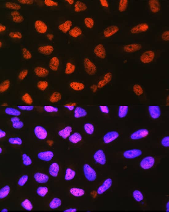 Immunocytochemistry/ Immunofluorescence: P4HA1 Antibody [NBP3-35149] - Immunofluorescence analysis of L929 cells using P4HA1 Rabbit pAb at dilution of 1:100 (40x lens). Secondary antibody: Cy3-conjugated Goat anti-Rabbit IgG (H+L) at 1:500 dilution. Blue: DAPI for nuclear staining.