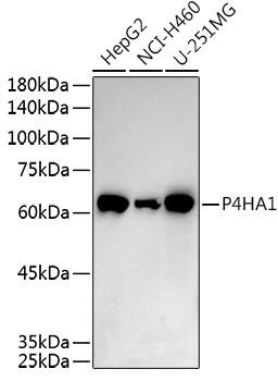 Western Blot: P4HA1 Antibody [NBP3-35149] - Western blot analysis of various lysates using P4HA1 Rabbit pAb at 1:500 dilution.Secondary antibody: HRP-conjugated Goat anti-Rabbit IgG (H+L) at 1:10000 dilution.Lysates/proteins: 25ug per lane.Blocking buffer: 3% nonfat dry milk in TBST.Detection: ECL Enhanced Kit.Exposure time: 60s.