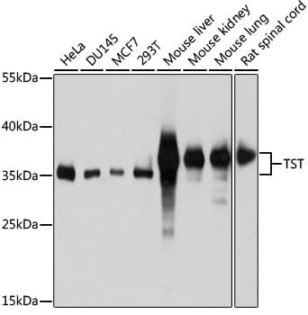 Western Blot: TST Antibody [NBP3-35150] - Western blot analysis of various lysates using TST Rabbit pAb at 1:1000 dilution.Secondary antibody: HRP-conjugated Goat anti-Rabbit IgG (H+L) at 1:10000 dilution.Lysates/proteins: 25ug per lane.Blocking buffer: 3% nonfat dry milk in TBST.Detection: ECL Basic Kit.Exposure time: 5s.