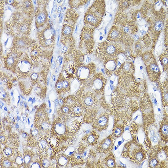 Immunohistochemistry: TST Antibody [NBP3-35150] - Immunohistochemistry analysis of paraffin-embedded Human liver using TST Rabbit pAb at dilution of 1:200 (40x lens). High pressure antigen retrieval performed with 0.01M Citrate Bufferr (pH 6.0) prior to IHC staining.