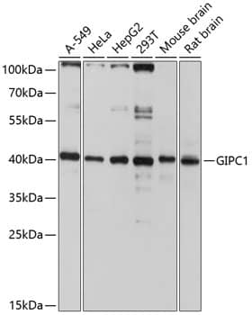 Western Blot: GIPC1 Antibody [NBP3-35151] - Western blot analysis of various lysates using GIPC1 Rabbit pAb at 1:3000 dilution.Secondary antibody: HRP-conjugated Goat anti-Rabbit IgG (H+L) at 1:10000 dilution.Lysates/proteins: 25ug per lane.Blocking buffer: 3% nonfat dry milk in TBST.Detection: ECL Basic Kit.Exposure time: 10s.