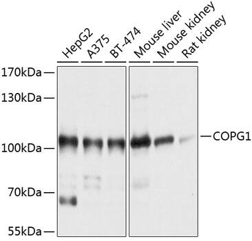 Western Blot: COPG Antibody [NBP3-35152] - Western blot analysis of various lysates using COPG Rabbit pAb at 1:1000 dilution.Secondary antibody: HRP-conjugated Goat anti-Rabbit IgG (H+L) at 1:10000 dilution.Lysates/proteins: 25ug per lane.Blocking buffer: 3% nonfat dry milk in TBST.Detection: ECL Basic Kit.Exposure time: 1s.