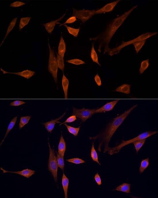 Immunocytochemistry/ Immunofluorescence: MST3 Antibody [NBP3-35153] - Immunofluorescence analysis of NIH/3T3 cells using MST3 Rabbit pAb at dilution of 1:200 (40x lens). Secondary antibody: Cy3-conjugated Goat anti-Rabbit IgG (H+L) at 1:500 dilution. Blue: DAPI for nuclear staining.