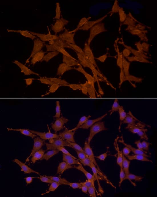 Immunocytochemistry/ Immunofluorescence: MST3 Antibody [NBP3-35153] - Immunofluorescence analysis of PC-12 cells using MST3 Rabbit pAb at dilution of 1:200 (40x lens). Secondary antibody: Cy3-conjugated Goat anti-Rabbit IgG (H+L) at 1:500 dilution. Blue: DAPI for nuclear staining.