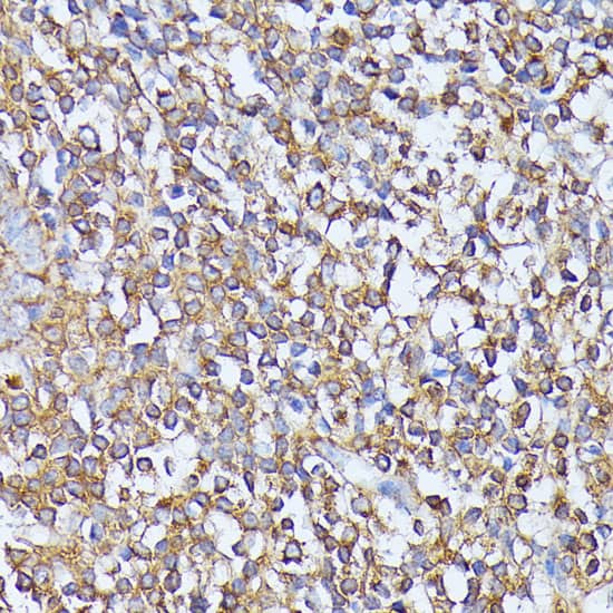 Immunohistochemistry: MST3 Antibody [NBP3-35153] - Immunohistochemistry analysis of paraffin-embedded Human tonsil using MST3 Rabbit pAb at dilution of 1:100 (40x lens). Microwave antigen retrieval performed with 0.01M PBS Buffer (pH 7.2) prior to IHC staining.