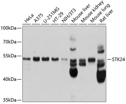 Western Blot: MST3 Antibody [NBP3-35153] - Western blot analysis of various lysates using MST3 Rabbit pAb at 1:1000 dilution.Secondary antibody: HRP-conjugated Goat anti-Rabbit IgG (H+L) at 1:10000 dilution.Lysates/proteins: 25ug per lane.Blocking buffer: 3% nonfat dry milk in TBST.Detection: ECL Basic Kit.Exposure time: 1s.