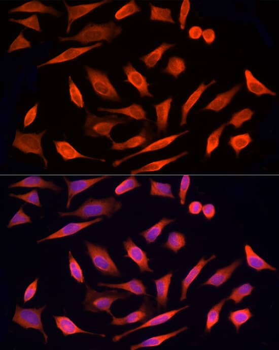 Immunocytochemistry/ Immunofluorescence: MST3 Antibody [NBP3-35153] - Immunofluorescence analysis of HeLa cells using MST3 Rabbit pAb at dilution of 1:200 (40x lens). Secondary antibody: Cy3-conjugated Goat anti-Rabbit IgG (H+L) at 1:500 dilution. Blue: DAPI for nuclear staining.