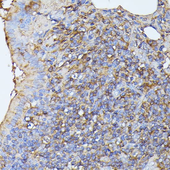 Immunohistochemistry: MST3 Antibody [NBP3-35153] - Immunohistochemistry analysis of paraffin-embedded Rat lung using MST3 Rabbit pAb at dilution of 1:100 (40x lens). Microwave antigen retrieval performed with 0.01M PBS Buffer (pH 7.2) prior to IHC staining.