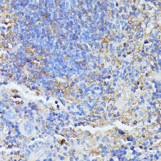 Immunohistochemistry: MST3 Antibody [NBP3-35153] - Immunohistochemistry analysis of paraffin-embedded Mouse spleen using MST3 Rabbit pAb at dilution of 1:100 (40x lens). Microwave antigen retrieval performed with 0.01M PBS Buffer (pH 7.2) prior to IHC staining.