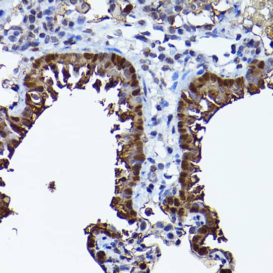 Immunohistochemistry: SEC14L2 Antibody [NBP3-35155] - Immunohistochemistry analysis of paraffin-embedded Rat lung using SEC14L2 Rabbit pAb at dilution of 1:200 (40x lens). High pressure antigen retrieval performed with 0.01M Citrate Bufferr (pH 6.0) prior to IHC staining.