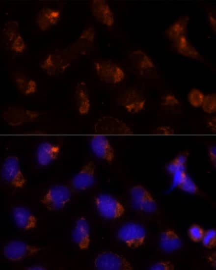 Immunocytochemistry/ Immunofluorescence: SEC14L2 Antibody [NBP3-35155] - Immunofluorescence analysis of U-2 OS cells using SEC14L2 Rabbit pAb at dilution of 1:100 (40x lens). Secondary antibody: Cy3-conjugated Goat anti-Rabbit IgG (H+L) at 1:500 dilution. Blue: DAPI for nuclear staining.