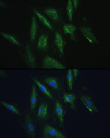 Immunocytochemistry/ Immunofluorescence: SRPRB Antibody [NBP3-35156] - Immunofluorescence analysis of H9C2 cells using SRPRB Rabbit pAb at dilution of 1:100. Blue: DAPI for nuclear staining.
