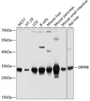 Western Blot: SRPRB Antibody [NBP3-35156] - Western blot analysis of various lysates using SRPRB Rabbit pAb at 1:1000 dilution.Secondary antibody: HRP-conjugated Goat anti-Rabbit IgG (H+L) at 1:10000 dilution.Lysates/proteins: 25ug per lane.Blocking buffer: 3% nonfat dry milk in TBST.Detection: ECL Basic Kit.Exposure time: 5s.
