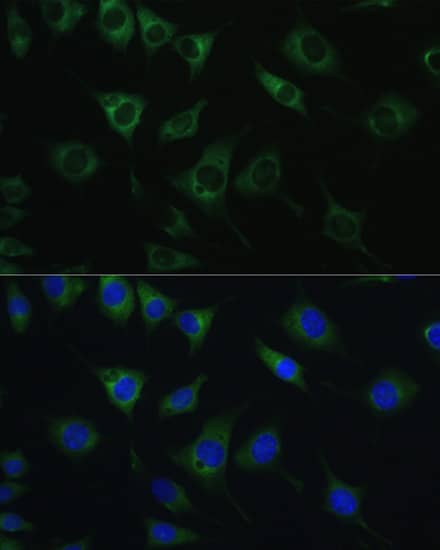 Immunocytochemistry/ Immunofluorescence: SRPRB Antibody [NBP3-35156] - Immunofluorescence analysis of L929 cells using SRPRB Rabbit pAb at dilution of 1:100. Blue: DAPI for nuclear staining.
