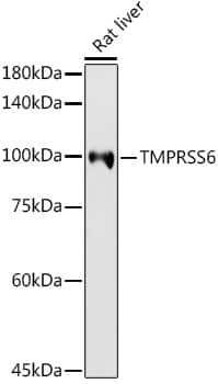 Western Blot Matriptase 2 Antibody