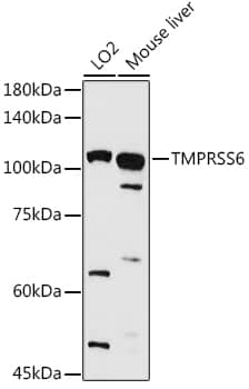 Western Blot Matriptase 2 Antibody