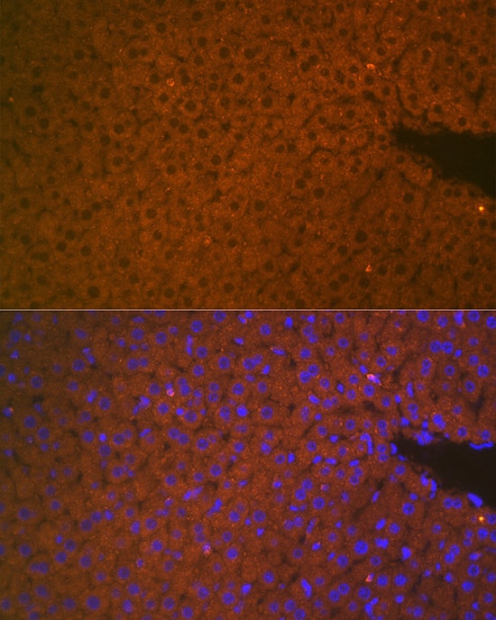 Immunocytochemistry/ Immunofluorescence Matriptase 2 Antibody