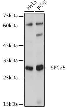 Western Blot: SPC25 Antibody [NBP3-35159] - Western blot analysis of various lysates using SPC25 Rabbit pAb at 1:1000 dilution.Secondary antibody: HRP-conjugated Goat anti-Rabbit IgG (H+L) at 1:10000 dilution.Lysates/proteins: 25ug per lane.Blocking buffer: 3% nonfat dry milk in TBST.Detection: ECL Basic Kit.Exposure time: 180s.