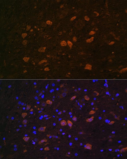 Immunocytochemistry/ Immunofluorescence: ELAVL4 Antibody [NBP3-35160] - Immunofluorescence analysis of paraffin-embedded Rat brain using ELAVL4 Rabbit pAb at dilution of 1:100. Secondary antibody: Cy3-conjugated Goat anti-Rabbit IgG (H+L) at 1:500 dilution. Blue: DAPI for nuclear staining.