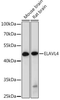 Western Blot: ELAVL4 Antibody [NBP3-35160] - Western blot analysis of various lysates using ELAVL4 Rabbit pAb at 1:1000 dilution.Secondary antibody: HRP-conjugated Goat anti-Rabbit IgG (H+L) at 1:10000 dilution.Lysates/proteins: 25ug per lane.Blocking buffer: 3% nonfat dry milk in TBST.Detection: ECL Basic Kit.Exposure time: 90s.